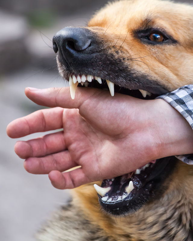 dogBites https://www.harrybrownlaw.com/wp-content/uploads/2026/02/dogBites.jpg